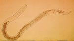 Root-Lesion Nematode